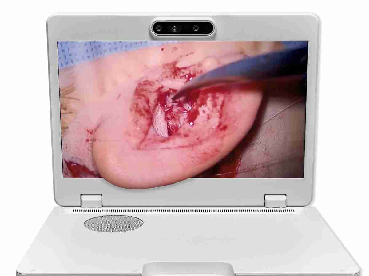 达擎之＂Heads-up 3D显微手术显示系统＂，，，整合4K裸眼3D显示及眼球追踪系统，，，，具备快速追踪人眼移动位置功能，，，减轻医师长时间维持固定姿势的负担，，，让医师能有更宽广清晰的3D立体视野及更舒适的姿势来执行手术。。。。